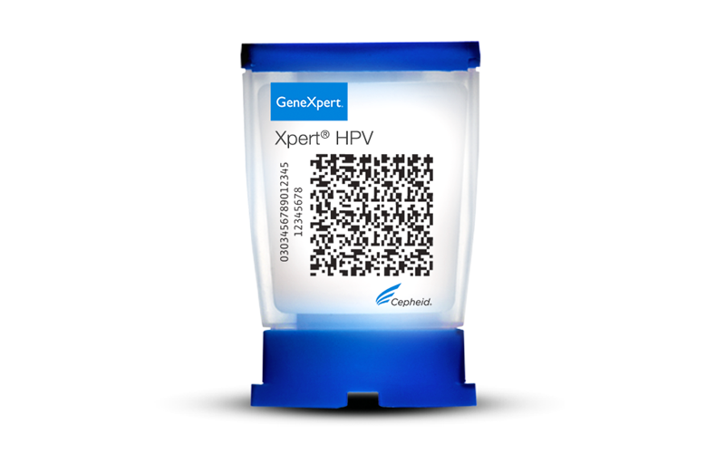 Тестирование мокроты на xpert mtb/rif. Xpert mtb. Крылья для горного велосипеда. Genexpert. Xpert mtb.